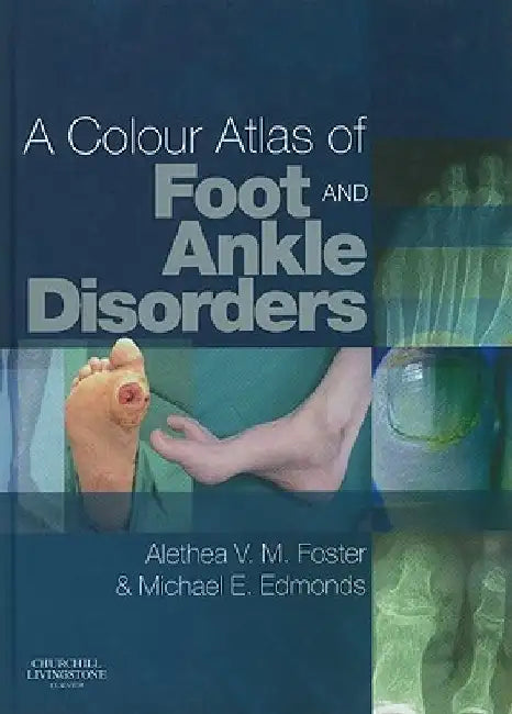 A Colour Atlas of Foot and Ankle Disorders by Alethea Vm Foster