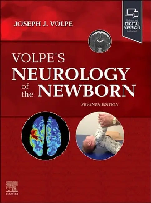 Volpe's Neurology of the Newborn by Joseph J. Volpe