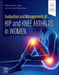 Evaluation and Management of Hip and Knee Arthritis in Women by Claudette M. Lajam