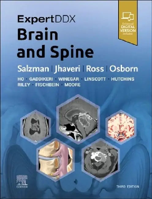 Expertddx: Brain and Spine by Karen L. Salzman