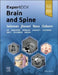 Expertddx: Brain and Spine by Karen L. Salzman