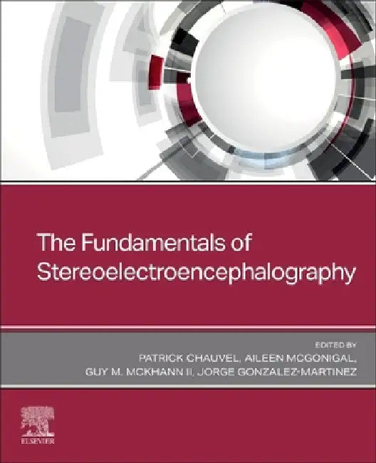 Stereoelectroencephalography by Patrick Chauvel