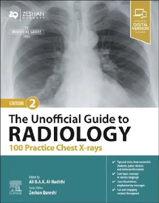 The Unofficial Guide to Radiology: 100 Practice Chest X Rays by Ali Al-Hadithi