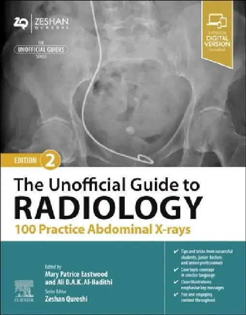 The Unofficial Guide to Radiology: 100 Practice Abdominal X Rays by Patrice Eastwood