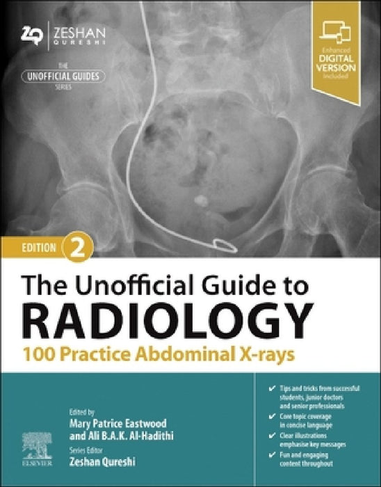 The Unofficial Guide to Radiology: 100 Practice Abdominal X Rays