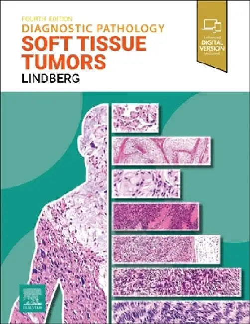 Diagnostic Pathology: Soft Tissue Tumors by Matthew R. Lindberg