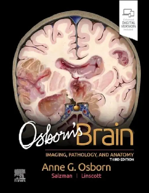 Osborn's Brain by Anne G. Osborn
