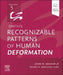 Smith's Recognizable Patterns of Human Deformation by John M. Graham
