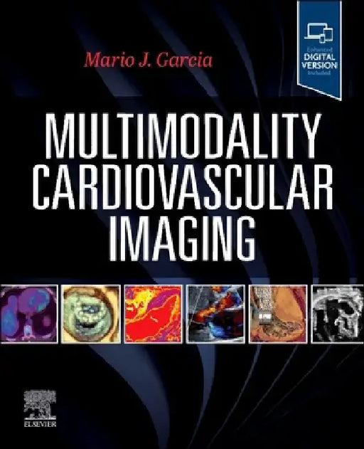 Multimodality Cardiovascular Imaging by Mario J. Garcia