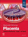Diagnostic Pathology: Placenta by Amy Heerema-Mckenney