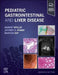 Pediatric Gastrointestinal and Liver Disease by Robert Wyllie