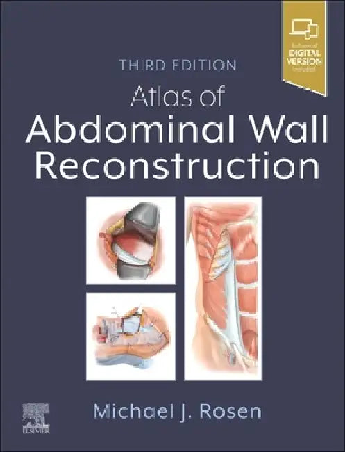 Atlas of Abdominal Wall Reconstruction by Michael J. Rosen