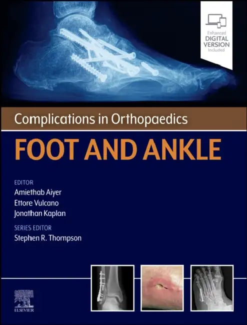 Complications in Orthopaedics: Foot and Ankle by Amiethab Aiyer, Ettore Vulcano, Jonathan Kaplan