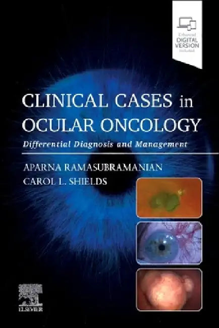 Clinical Cases in Ocular Oncology: Differential Diagnosis and Management by Aparna Ramasubramanian