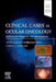 Clinical Cases in Ocular Oncology: Differential Diagnosis and Management by Aparna Ramasubramanian