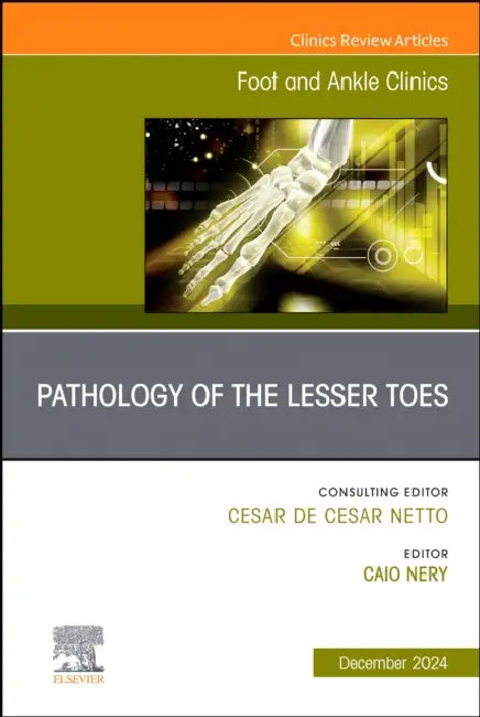 Pathology of the Lesser Toes, an Issue of Foot and Ankle Clinics of North America: Volume 29-4 by Caio Nery