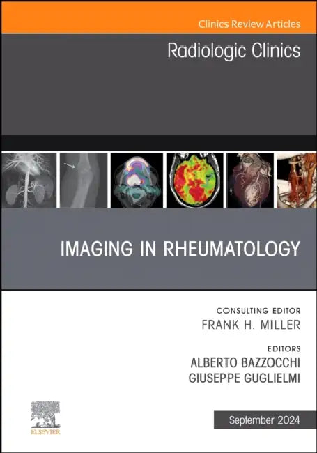 Imaging in Rheumatology, an Issue of Radiologic Clinics of North America: Volume 62-5 by Alberto Bazzocchi, Giuseppe Guglielmi
