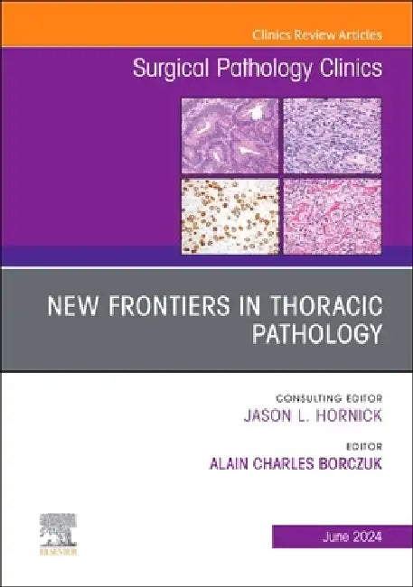 New Frontiers in Thoracic Pathology, an Issue of Surgical Pathology Clinics: Volume 17-2 by Alain Charles Borczuk