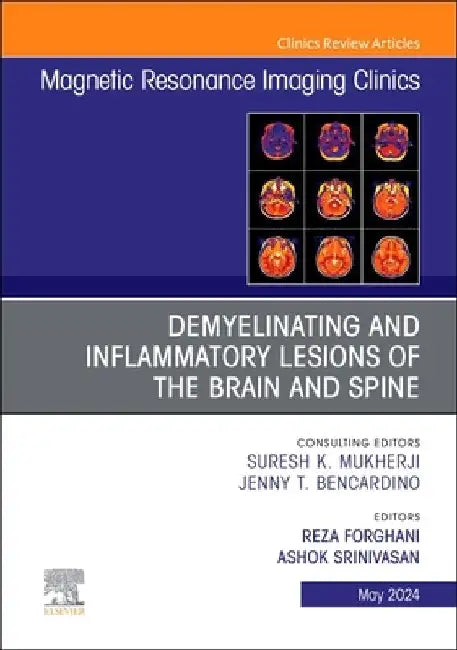 Demyelinating and Inflammatory Lesions of the Brain and Spine, an Issue of Magnetic Resonance Imaging Clinics of North America: Volume 32-2 by Reza Forghani