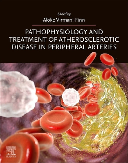 Pathophysiology and Treatment of Atherosclerotic Disease in Peripheral Arteries by Aloke Virmani Finn