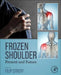 Frozen Shoulder: Present and Future by Filip Struyf