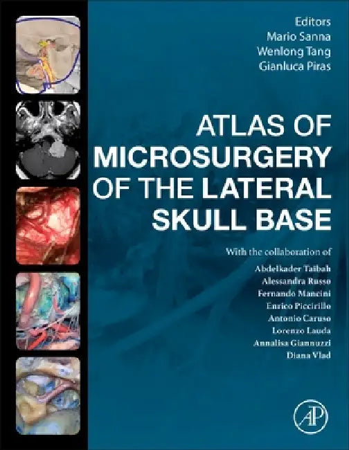 Atlas of Microsurgery of the Lateral Skull Base by Mario Sanna, Gianluca Piras, Wenlong Tang