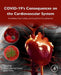 COVID-19’s Consequences on the Cardiovascular System: Immediate, Intermediate, and Long-Term Complications by Fabian Sanchis-Gomar