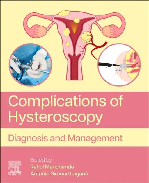 Complications of Hysteroscopy: Diagnosis and Management by Rahul Manchanda