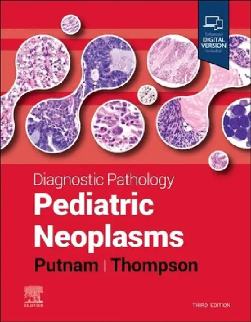 Diagnostic Pathology: Pediatric Neoplasms by Angelica R. Putnam