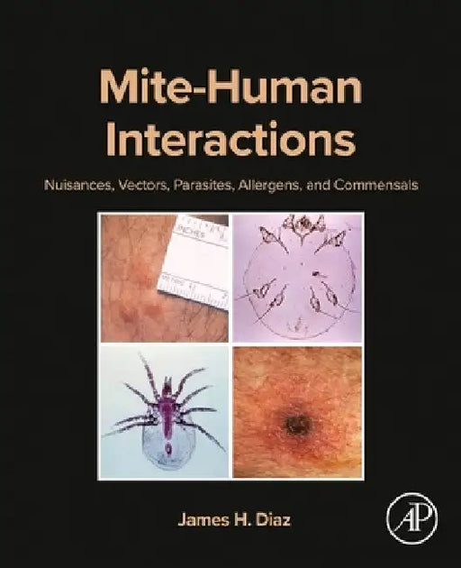 Mite-Human Interactions: Nuisances, Vectors, Parasites, Allergens, and Commensals by James H. Diaz