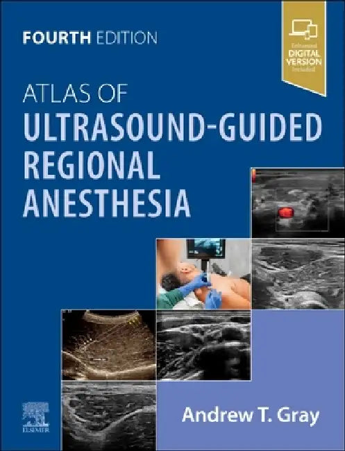 Atlas of Ultrasound-Guided Regional Anesthesia by Andrew T. Gray