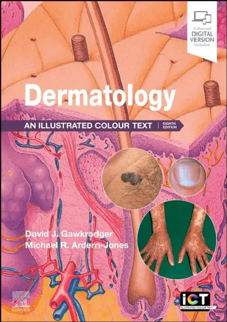 Dermatology: An Illustrated Colour Text by David Gawkrodger, Michael R. Ardern-Jones