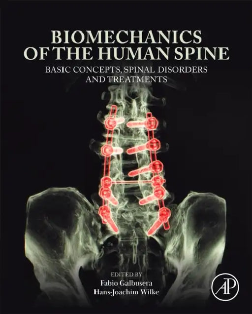 Biomechanics of the Human Spine: Basic Concepts, Spinal Disorders and Treatments by Fabio Galbusera