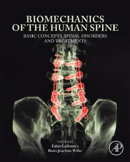 Biomechanics of the Human Spine: Basic Concepts, Spinal Disorders and Treatments by Fabio Galbusera