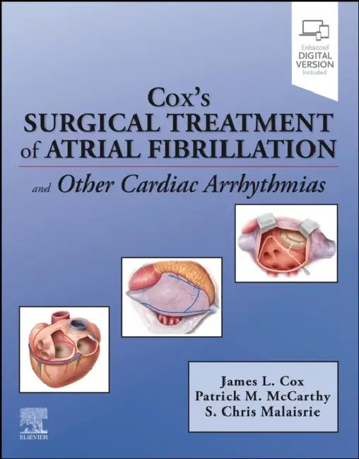 Cox's Surgical Treatment of Atrial Fibrillation by James L. Cox, Patrick M. McCarthy, S. Chris Malaisrie