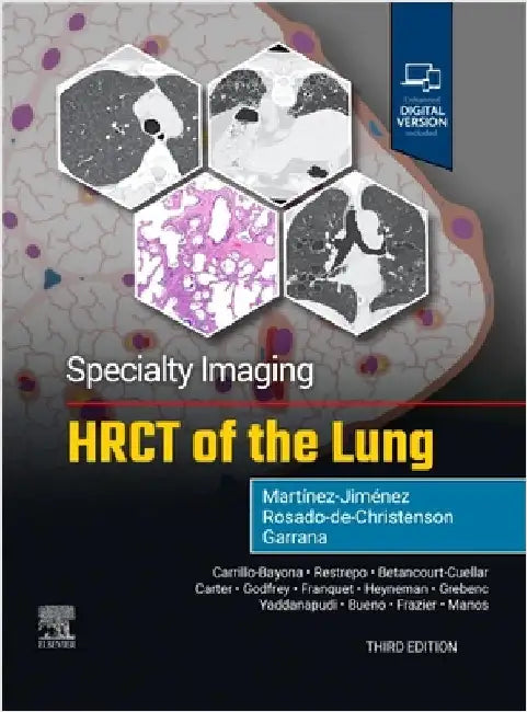 Specialty Imaging: Hrct of the Lung by Santiago MartÃ­nez-JimÃ©nez
