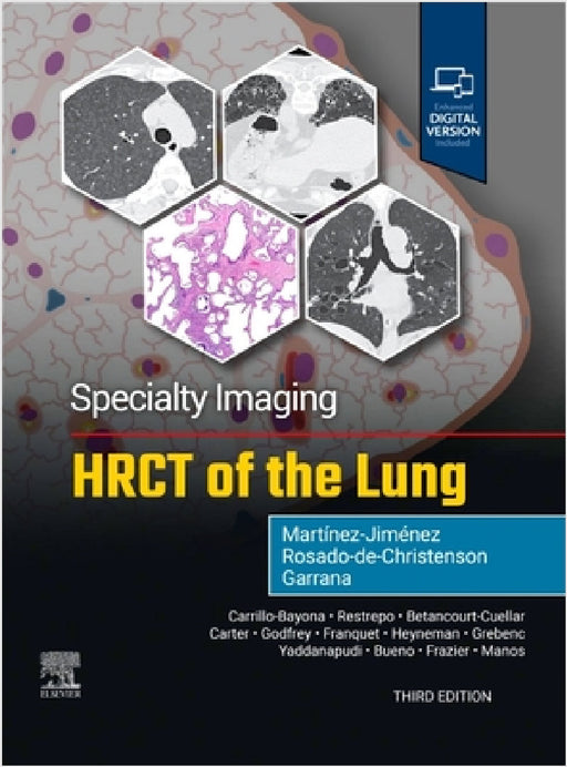Specialty Imaging: Hrct of the Lung by Santiago Martínez-Jiménez, Melissa L. Rosado-De-Christenson, Sherief Garrana