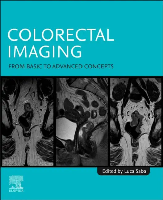Colorectal Imaging: From Basic to Advanced Concepts by Luca Saba