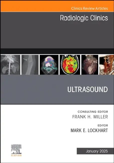 Ultrasound, an Issue of Radiologic Clinics of North America: Volume 63-1 by Mark E. Lockhart