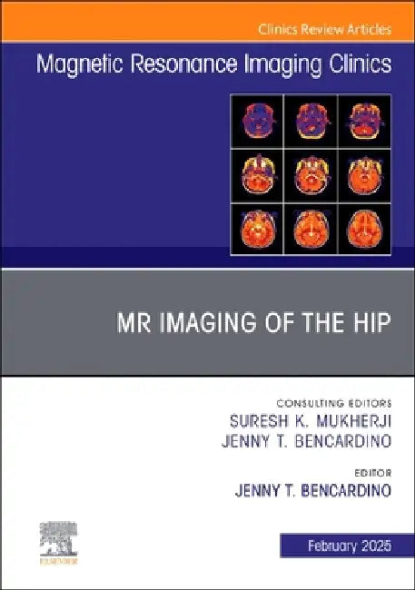 MR Imaging of the Hip, an Issue of Magnetic Resonance Imaging Clinics of North America: Volume 33-1 by Jenny T. Bencardino