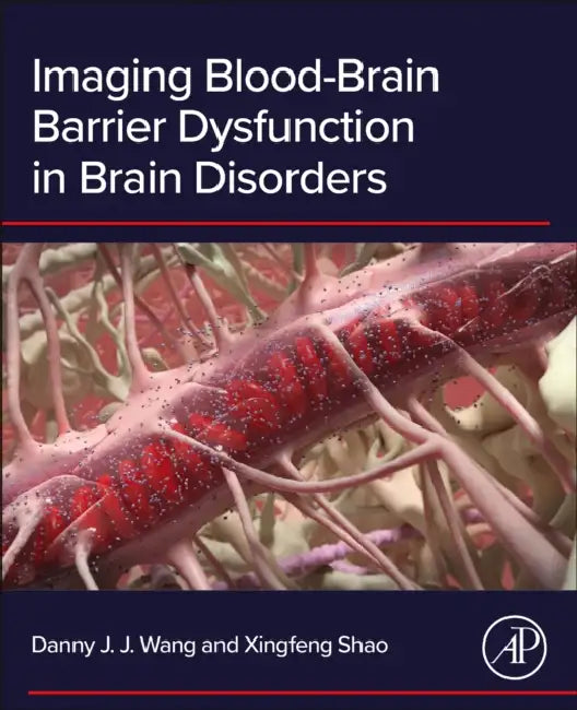 Imaging Blood-Brain Barrier Dysfunction in Brain Disorders by Danny J. J. Wang