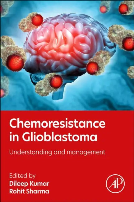 Chemoresistance in Glioblastoma: Understanding and Management by Dileep Kumar