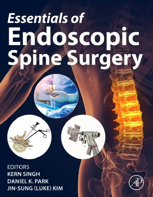 Essentials of Endoscopic Spine Surgery by Kern Singh