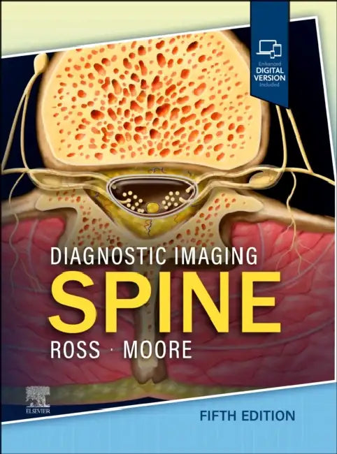 Diagnostic Imaging: Spine by Jeffrey S. Ross, Kevin R. Moore