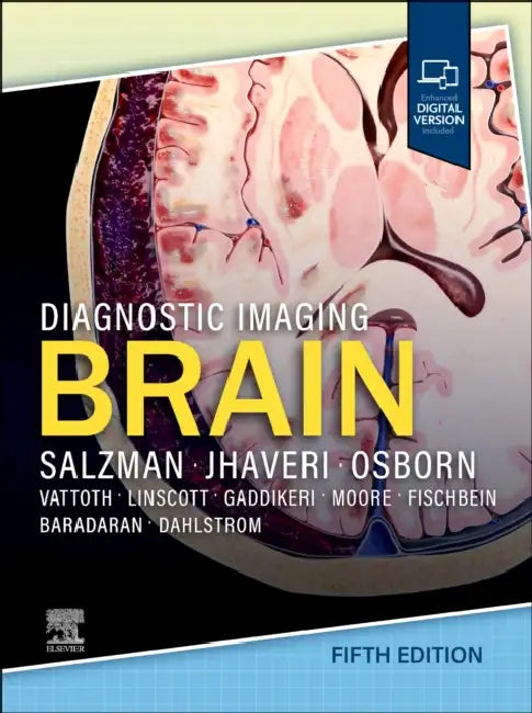 Diagnostic Imaging: Brain by Karen L. Salzman, Miral D. Jhaveri