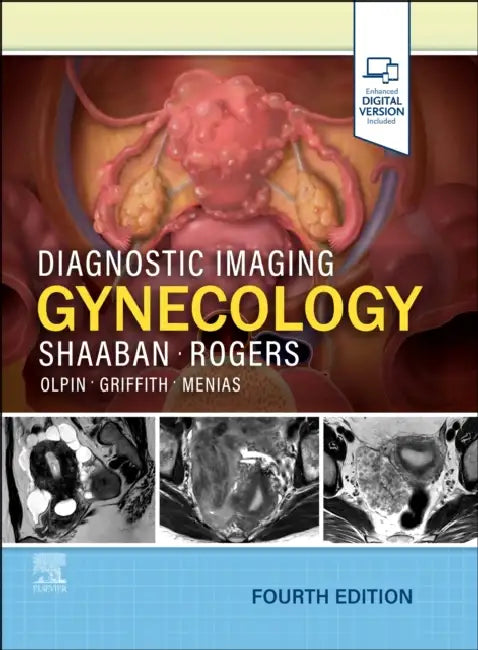 Diagnostic Imaging: Gynecology by Akram M. Shaaban, Douglas Rogers