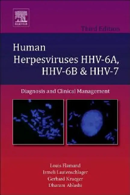 Human Herpesviruses HHV-6A, HHV-6B and HHV-7: Diagnosis and Clinical Management by Louis Flamand