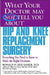 What Your Doctor May Not Tell You about Hip and Knee Replacement Surgery: Everything You Need to Know to Make the Right Decisions by Ronald P. Grelsamer