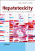 Hepatotoxicity: From Genomics to In Vitro and In Vivo Models by Editor: Saura C. Sahu