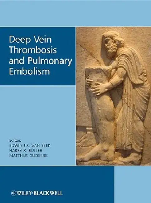 Deep Vein Thrombosis and Pulmonary Embolism by Edwin J. R. Van Beek